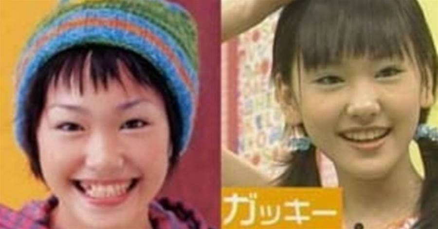 整形した女優13選！